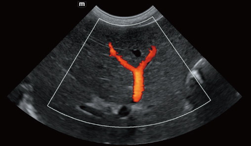 Portal vein of canine